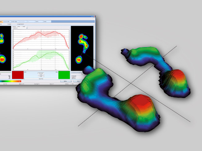 Esame baropodometrico